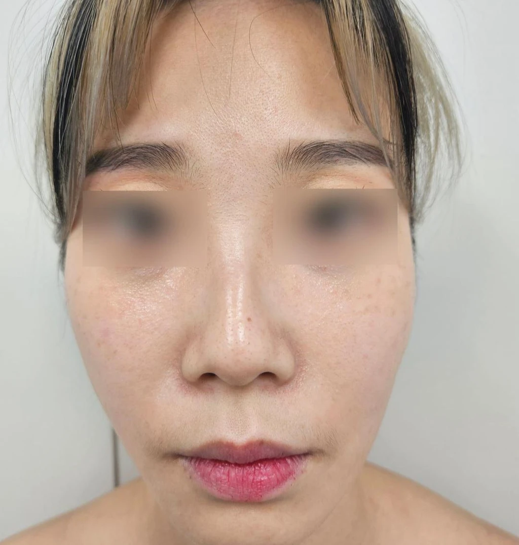before_image