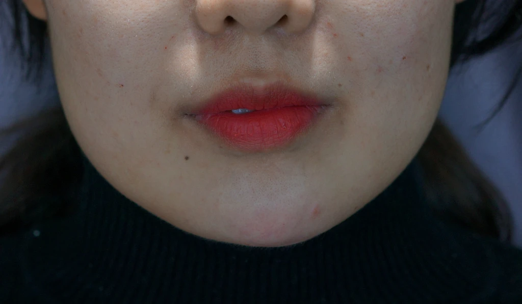 before_image