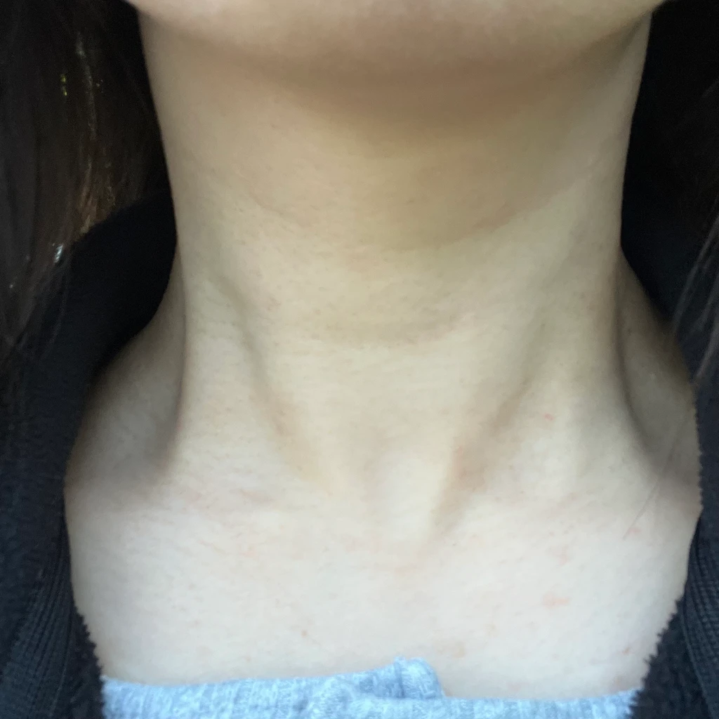before_image