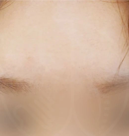 before_image