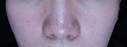 before_image