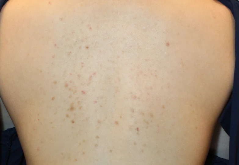 before_image