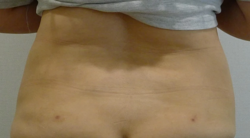before_image