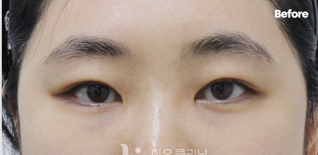 before_image