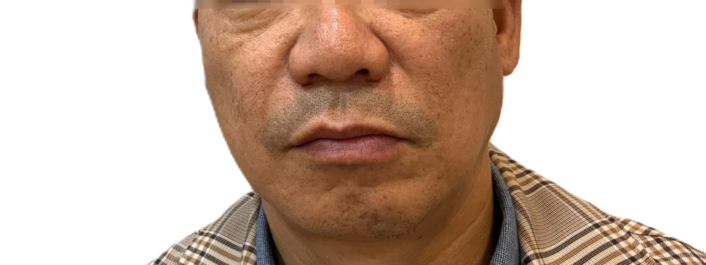 before_image