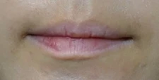 before_image
