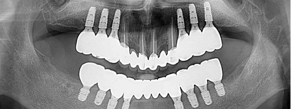 before_image