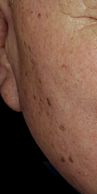 before_image