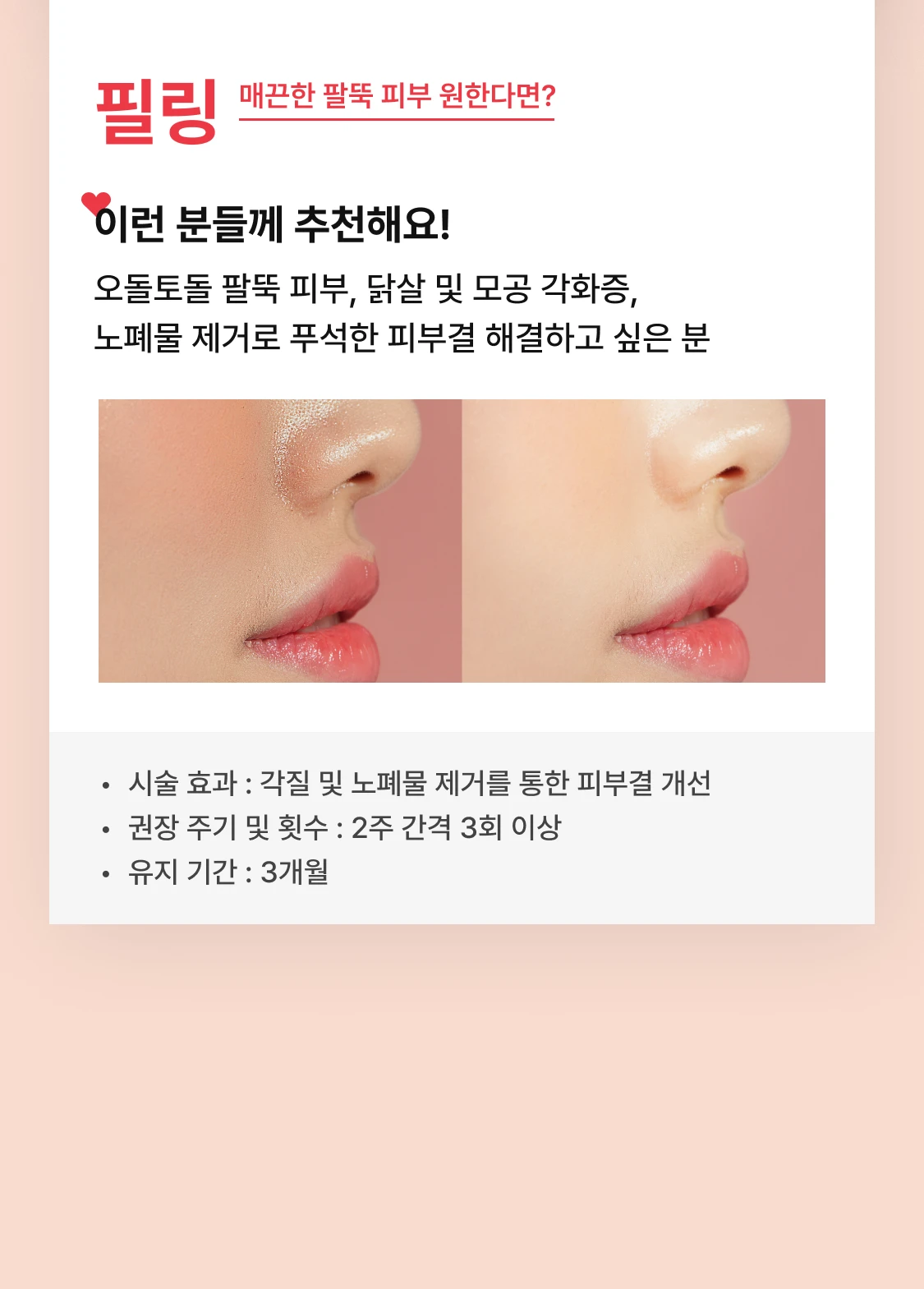 promotion-thumbnail