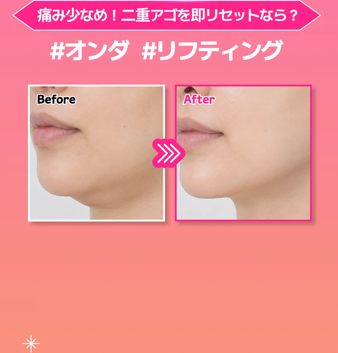 promotion-thumbnail