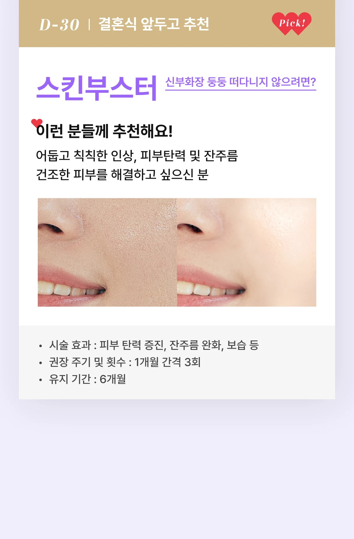 promotion-thumbnail