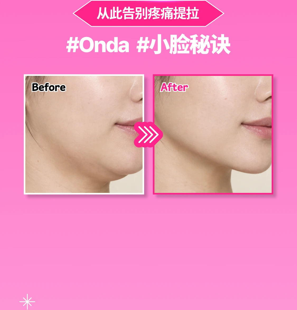 promotion-thumbnail