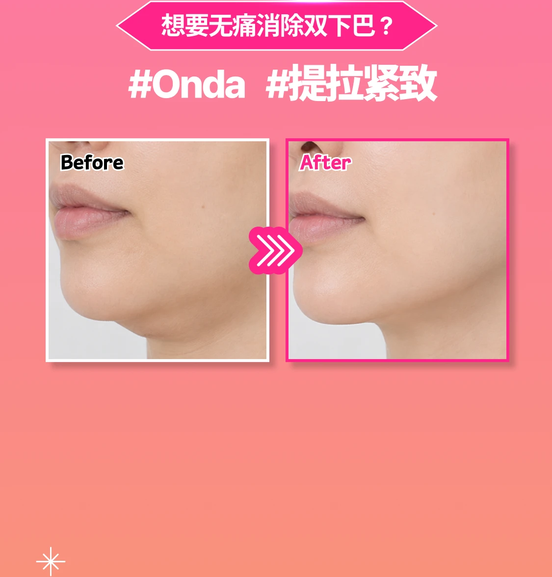 promotion-thumbnail