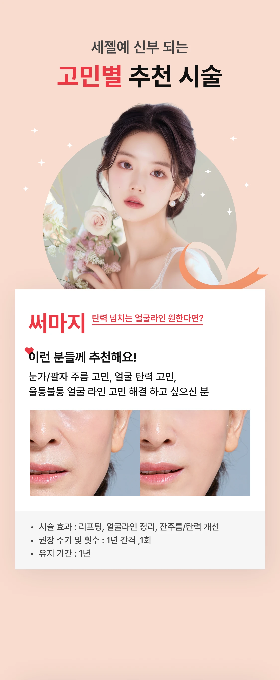 promotion-thumbnail
