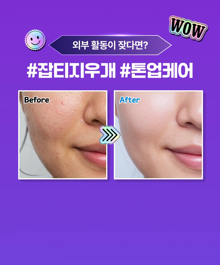 promotion-thumbnail