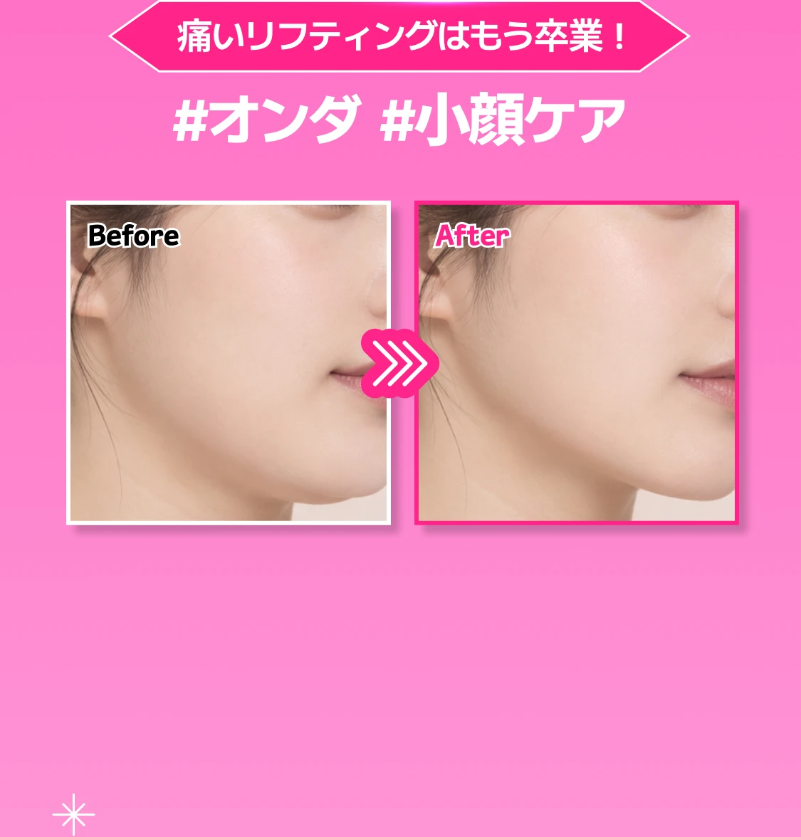 promotion-thumbnail