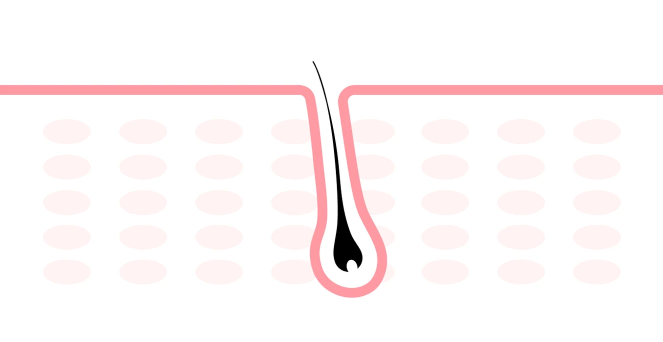 미라드라이-2
